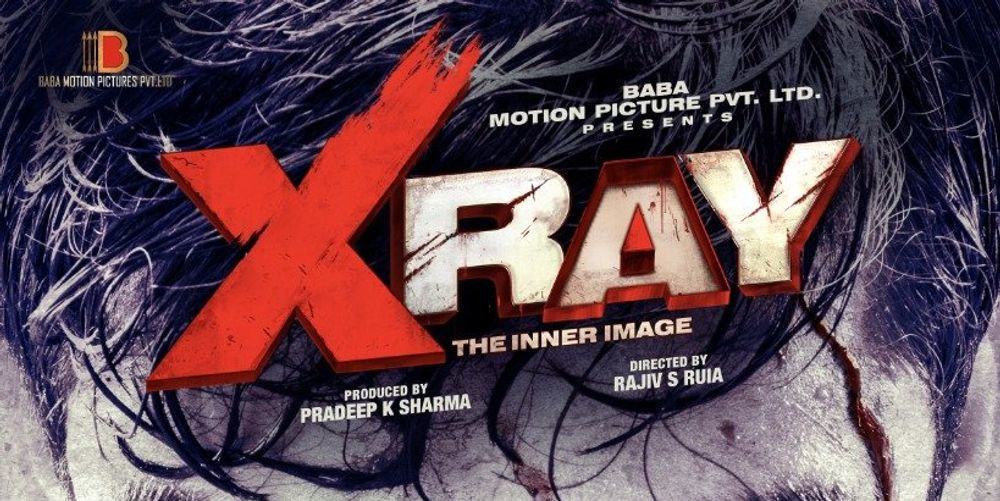 X Ray