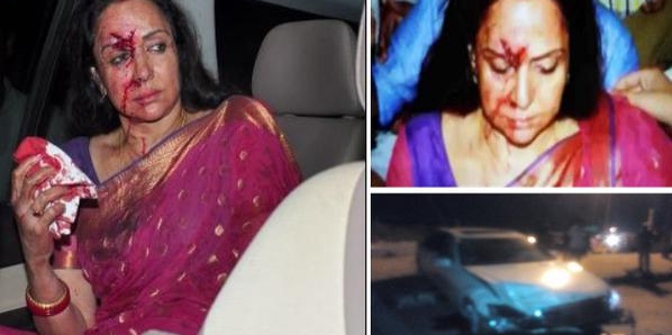 Hema Malini injured in a road accident in Rajasthan!!